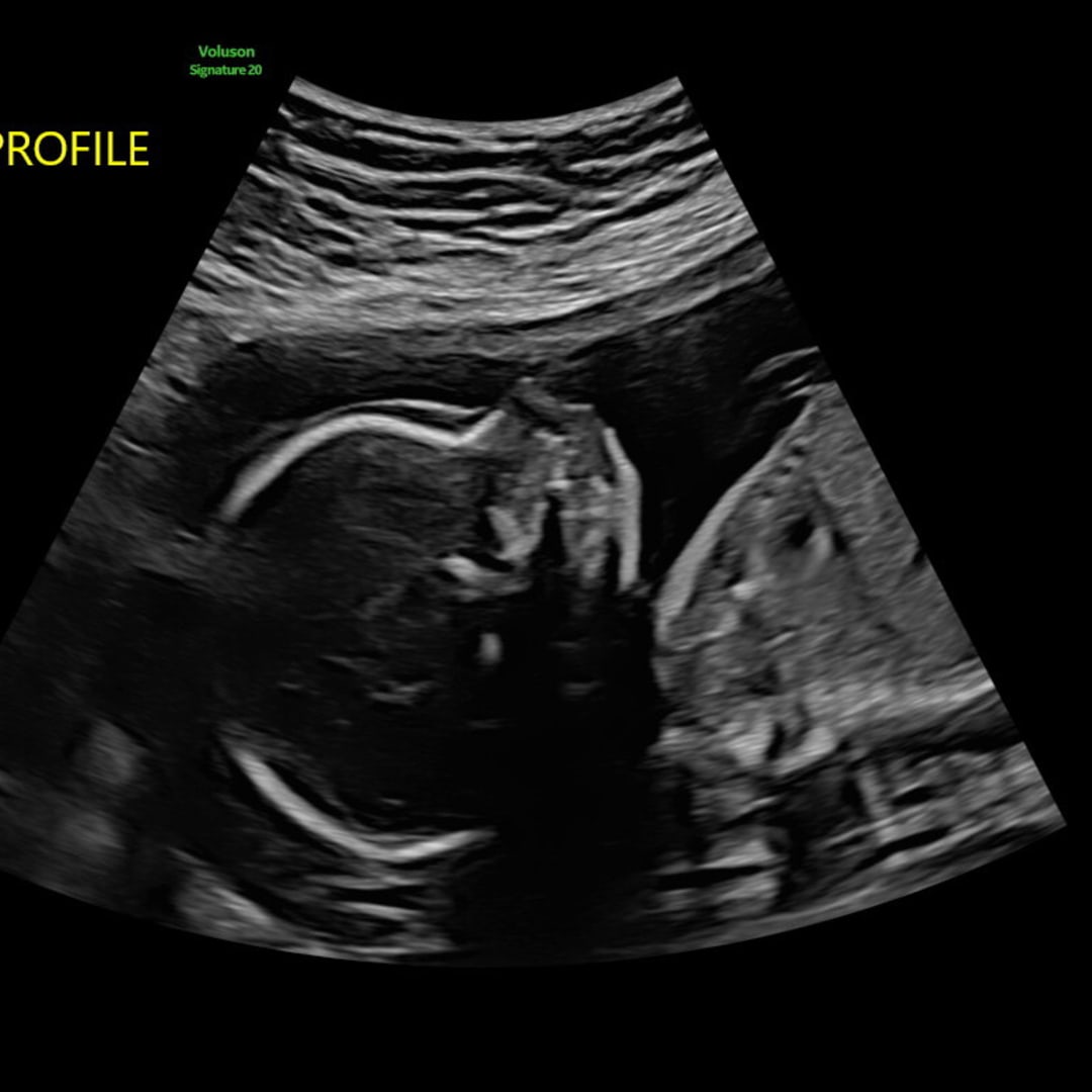 Photo shared by Agusta for their Babylist baby registry.