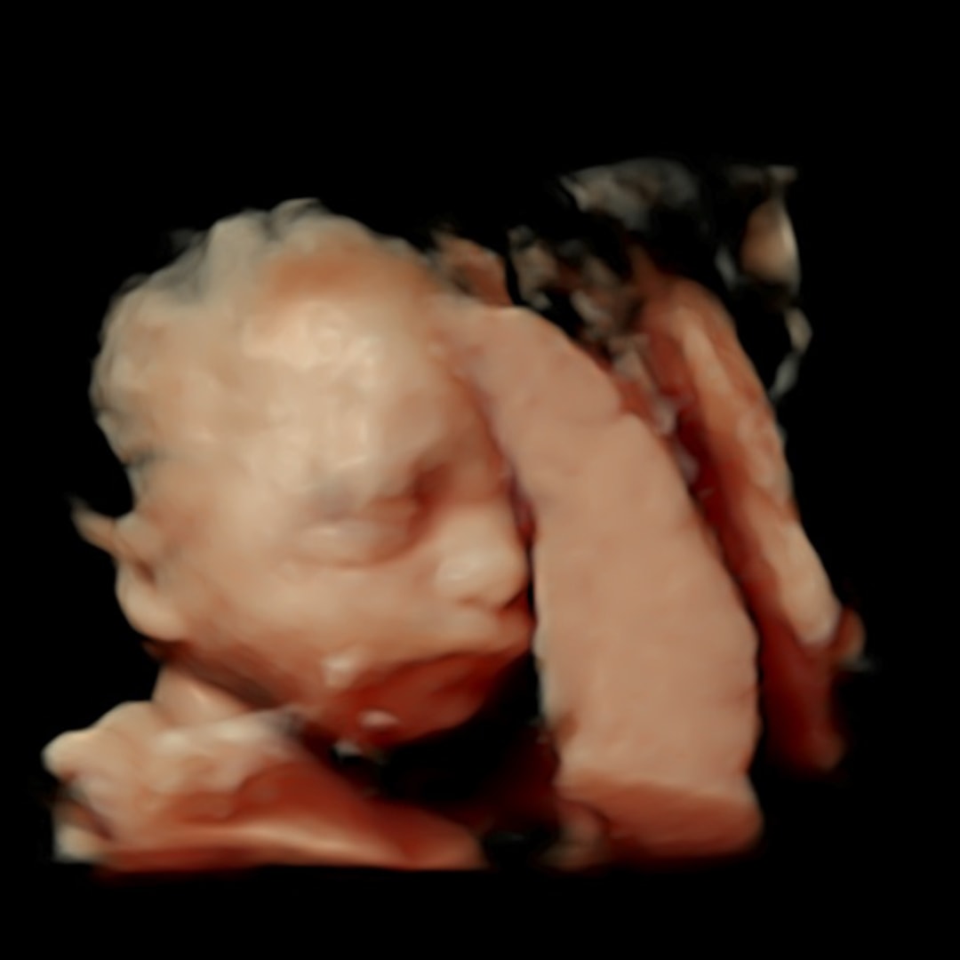 Photo shared by Seanna for their Babylist baby registry.