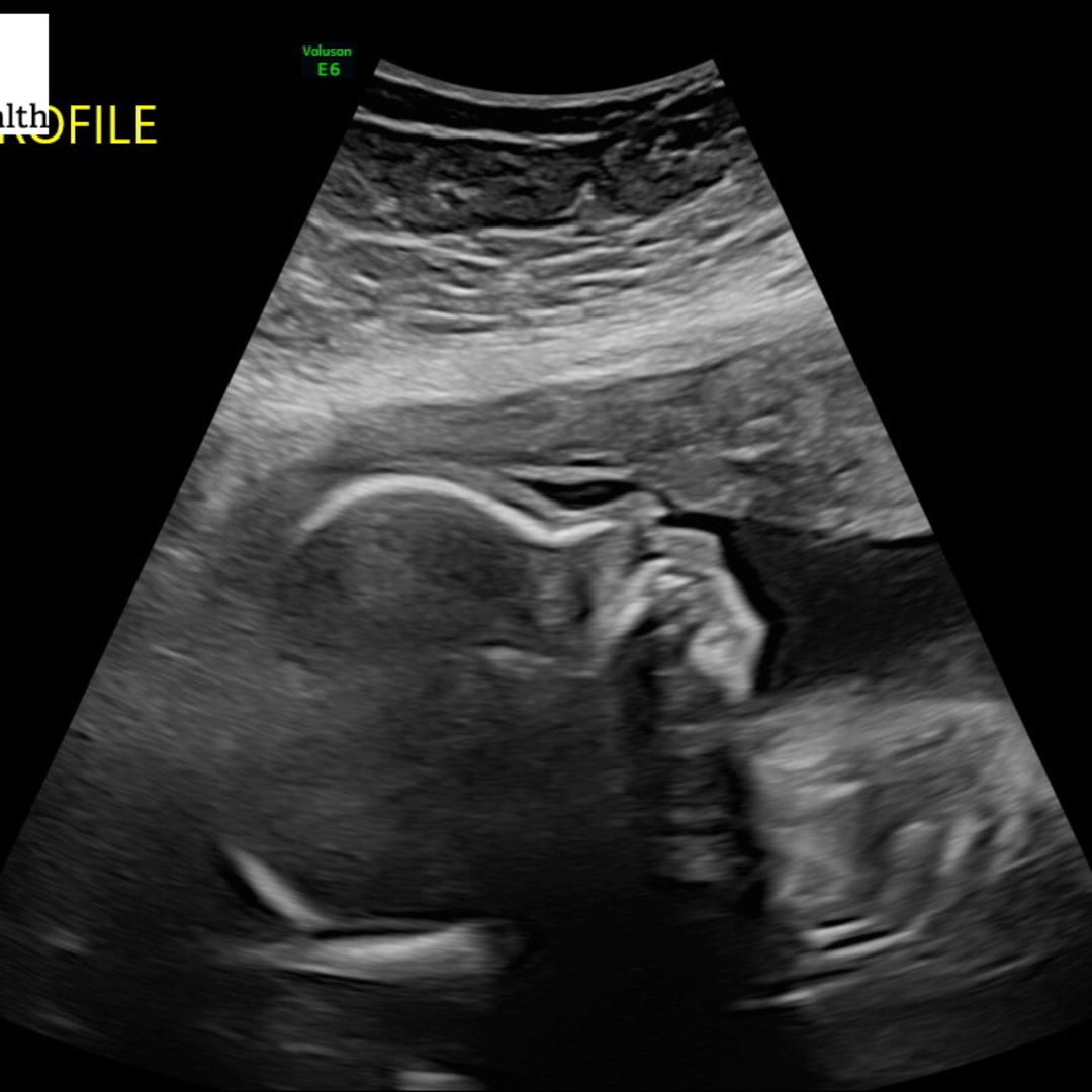 Photo shared by Jessica for their Babylist baby registry.