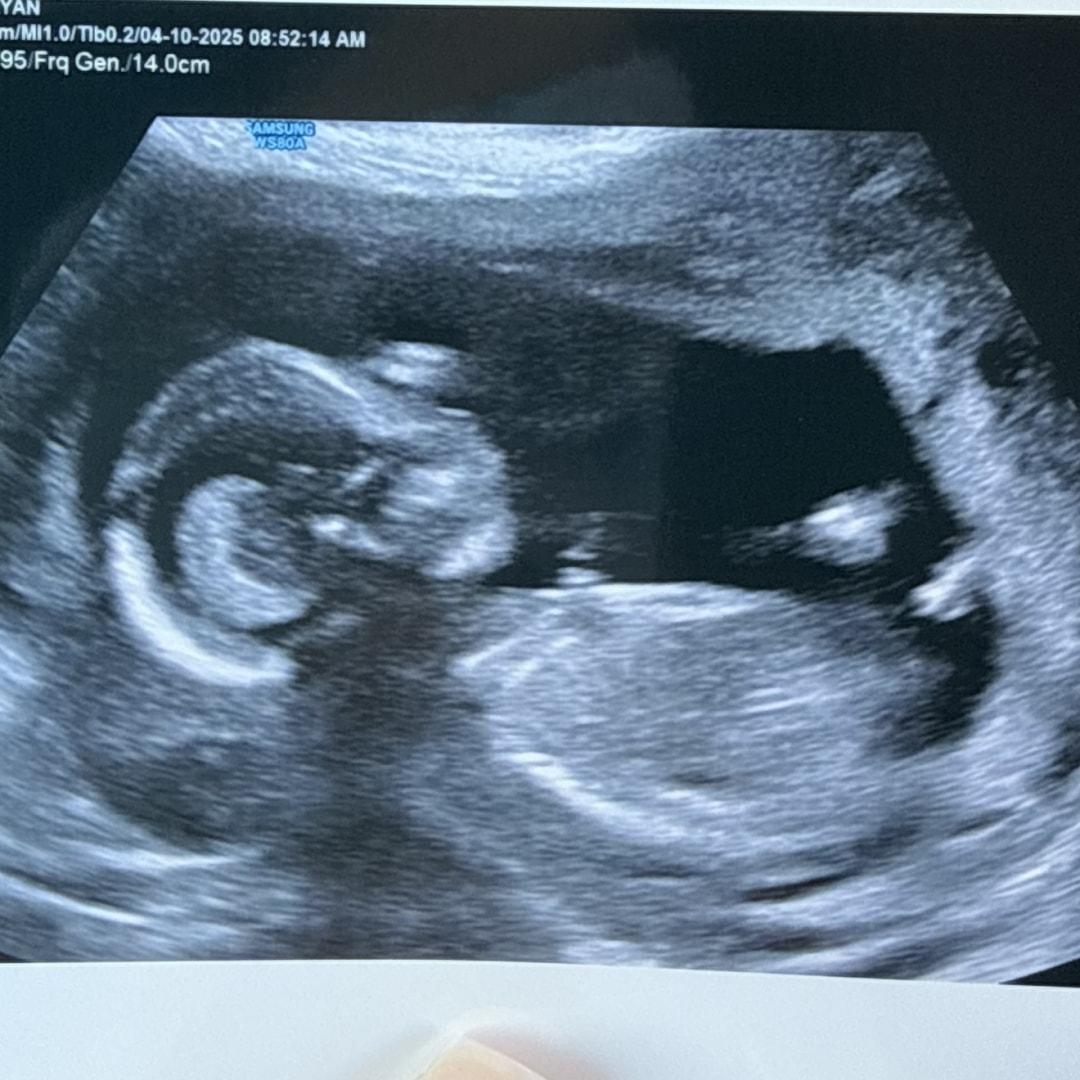 Photo shared by Ulani for their Babylist baby registry.