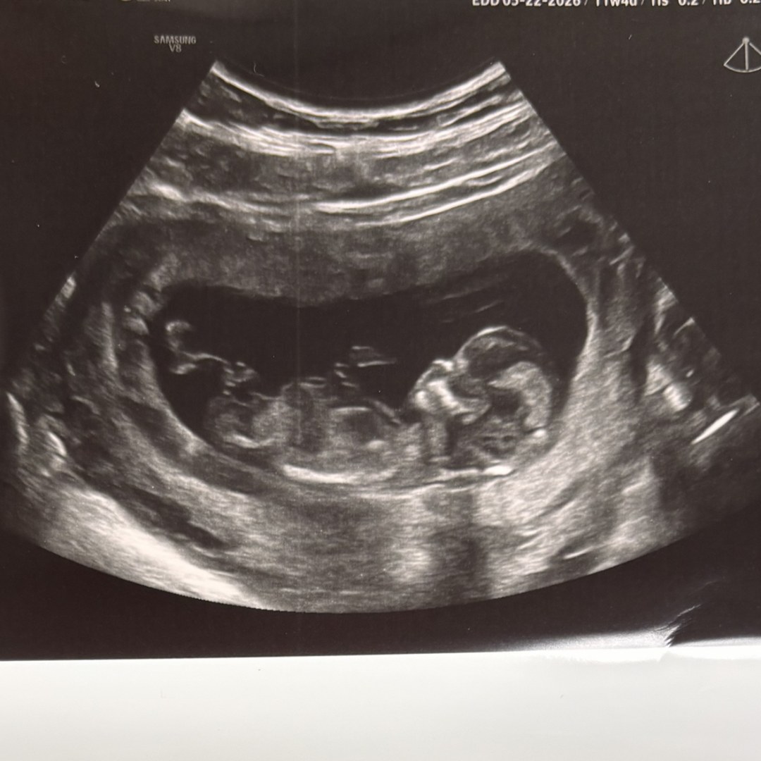 Photo shared by Karlee for their Babylist baby registry.