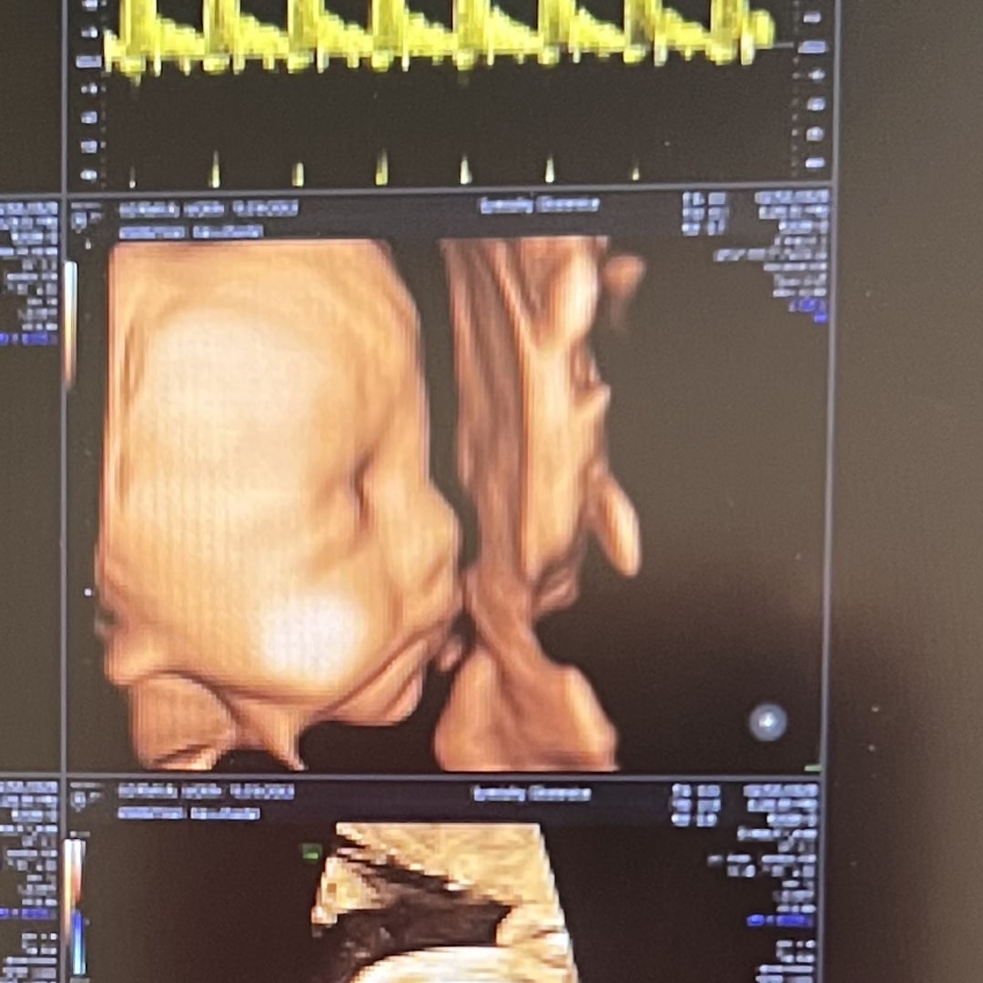 Photo shared by Jaden for their Babylist baby registry.