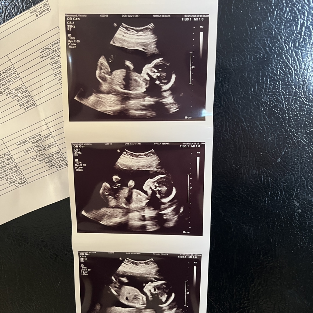 Photo shared by Victoria for their Babylist baby registry.