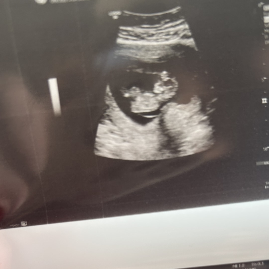 Photo shared by Emily for their Babylist baby registry.