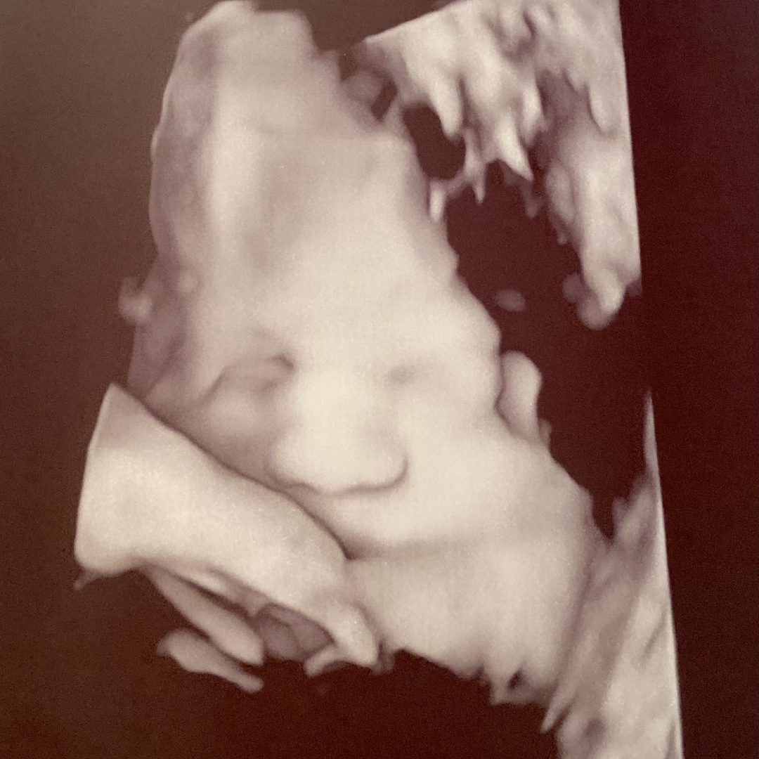 Photo shared by Lanette for their Babylist baby registry.