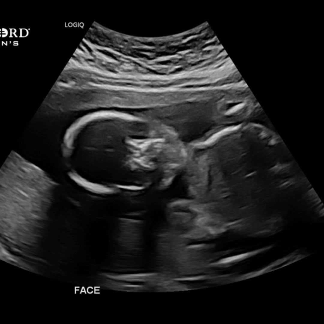 Photo shared by Maddi for their Babylist baby registry.