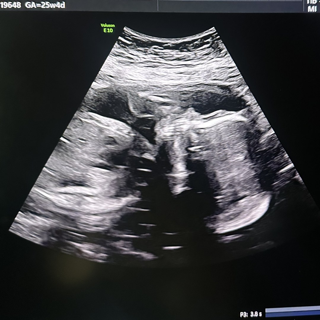 Photo shared by Jasmin for their Babylist baby registry.