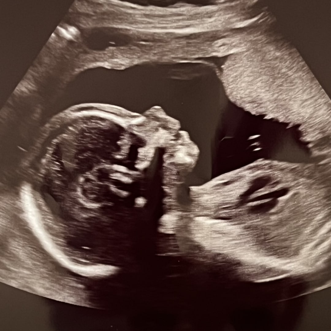 Photo shared by Chelsea for their Babylist baby registry.