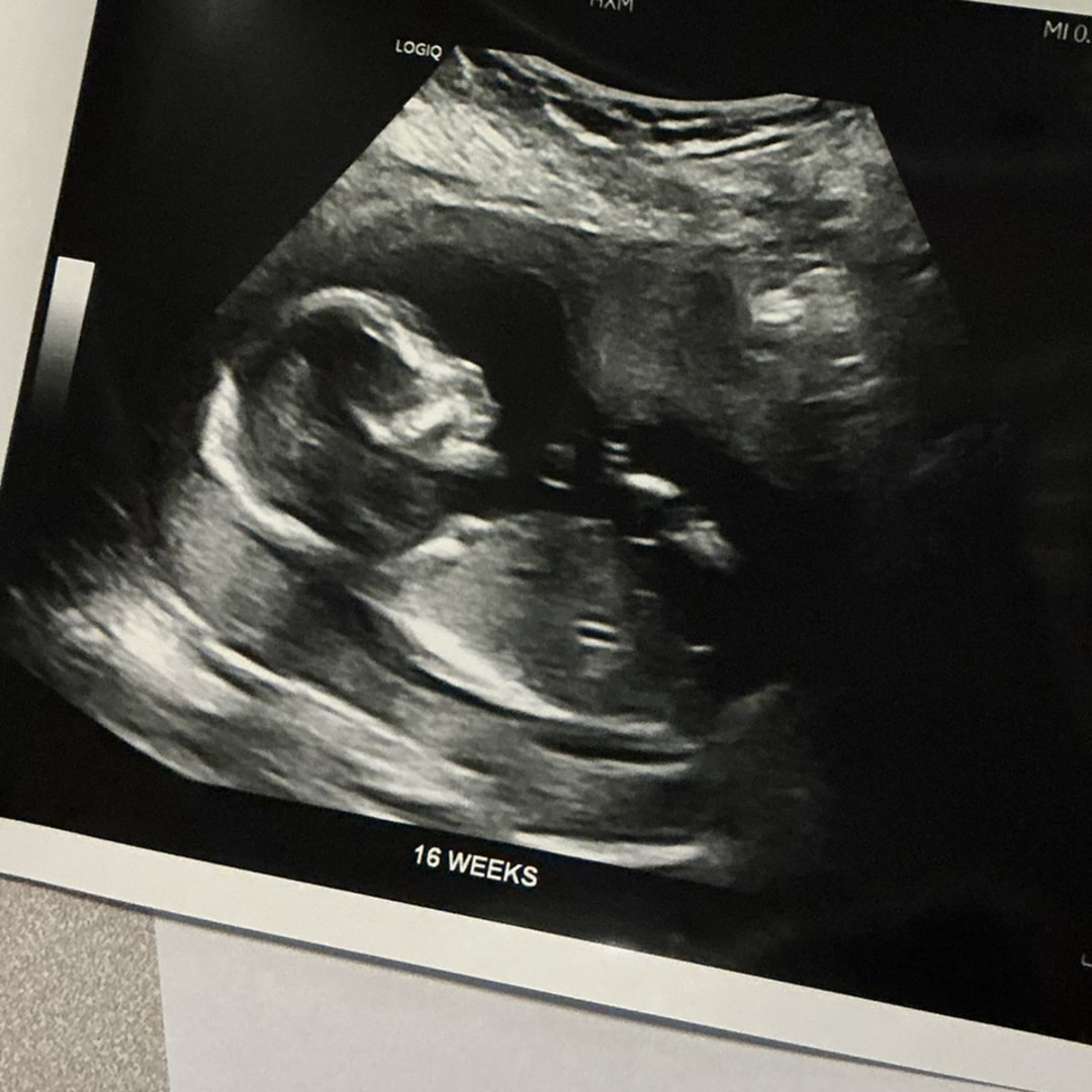 Photo shared by Hannah for their Babylist baby registry.