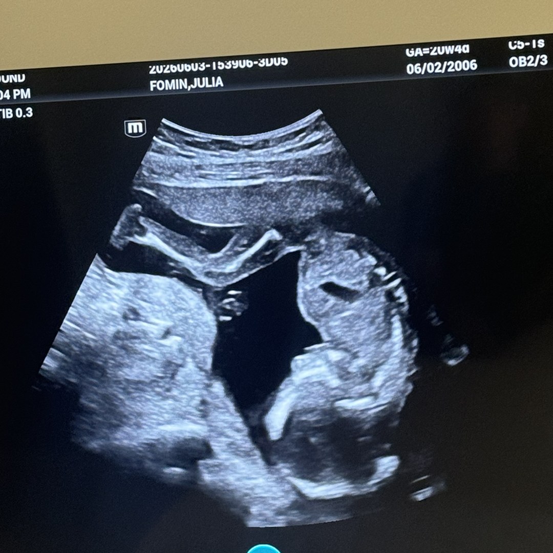 Photo shared by Julia for their Babylist baby registry.