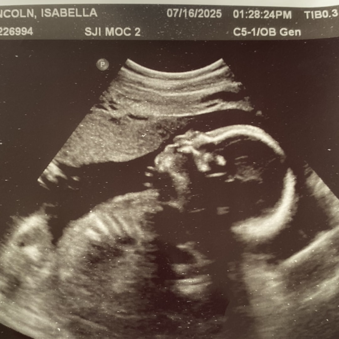 Photo shared by Isabella for their Babylist baby registry.