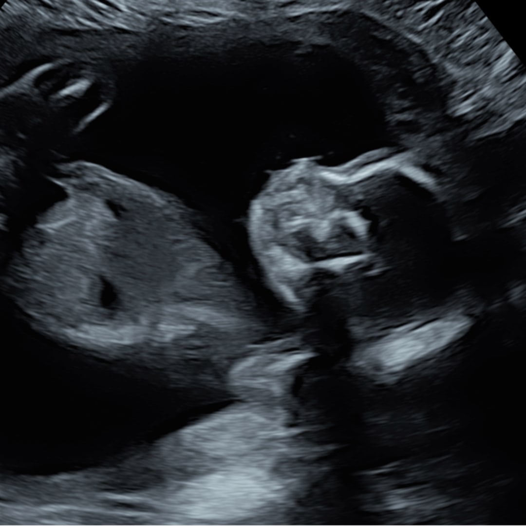 Photo shared by Jacie for their Babylist baby registry.