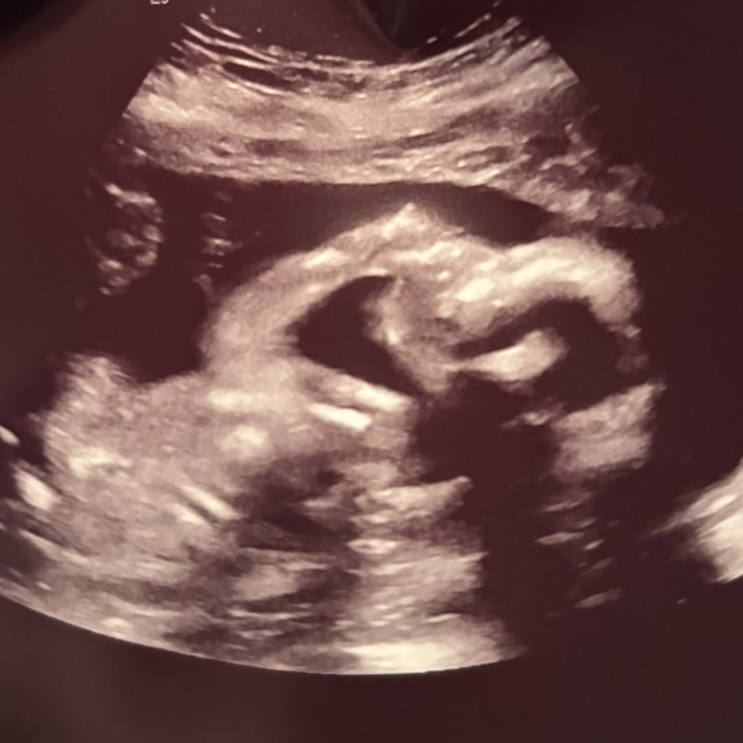 Photo shared by Mary for their Babylist baby registry.