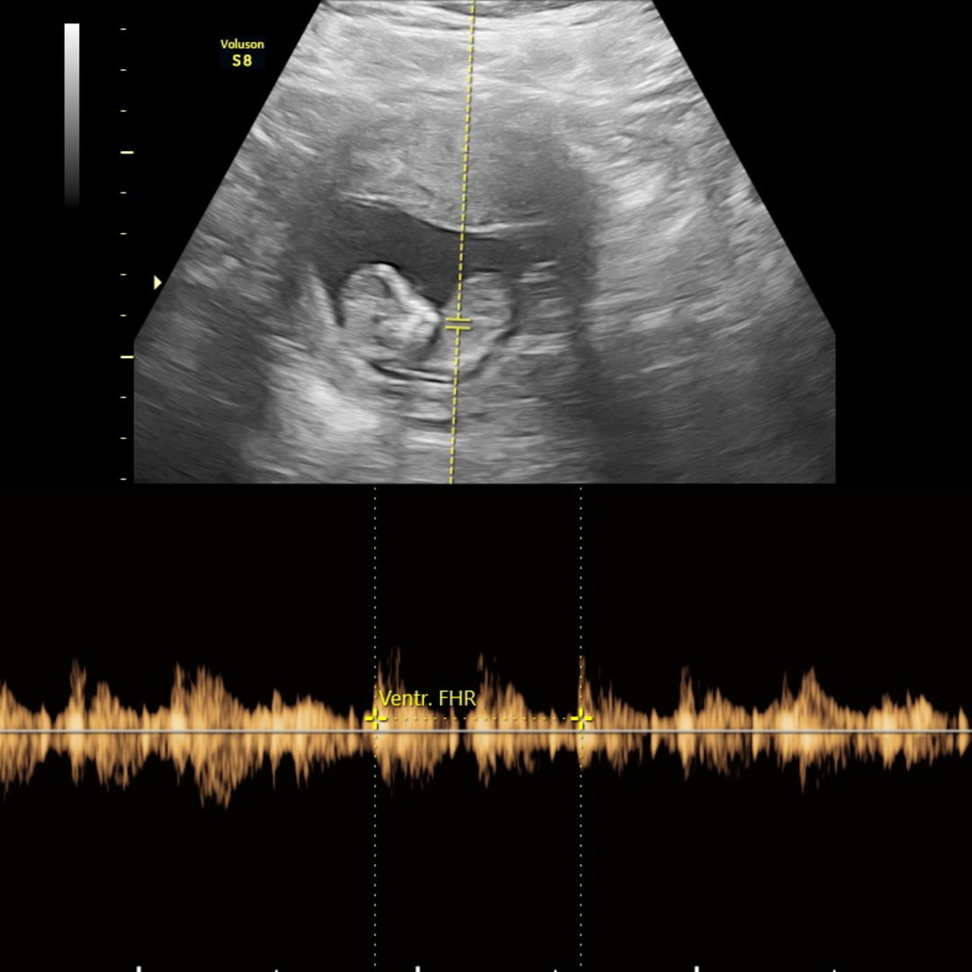 Photo shared by Brittany for their Babylist baby registry.