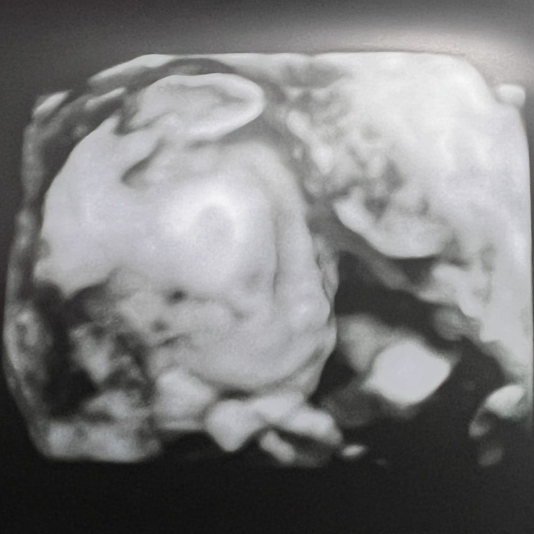 Photo shared by Edith for their Babylist baby registry.
