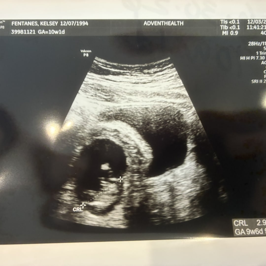 Photo shared by Kelsey for their Babylist baby registry.