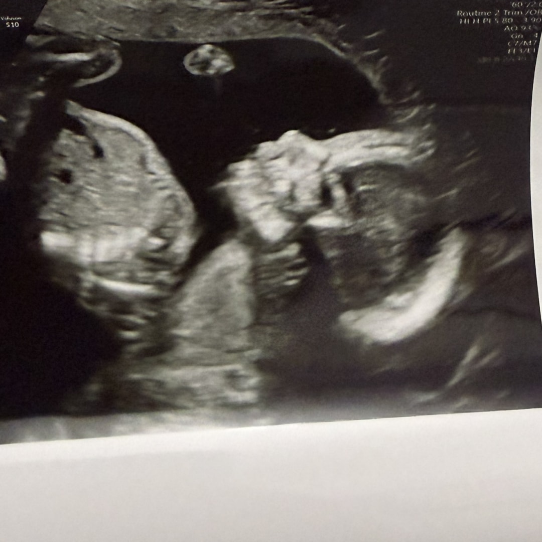 Photo shared by Bailey for their Babylist baby registry.