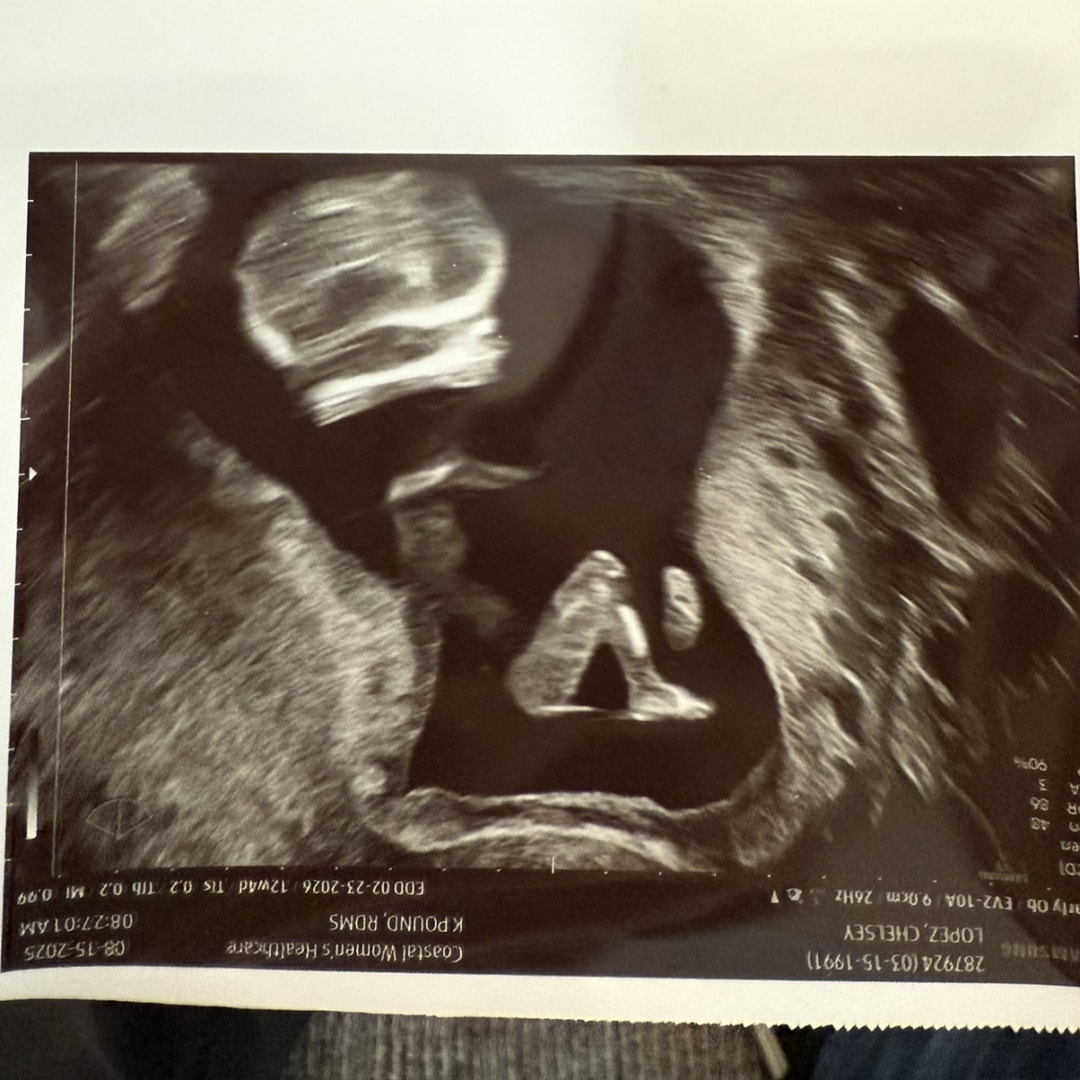 Photo shared by Chelsey for their Babylist baby registry.