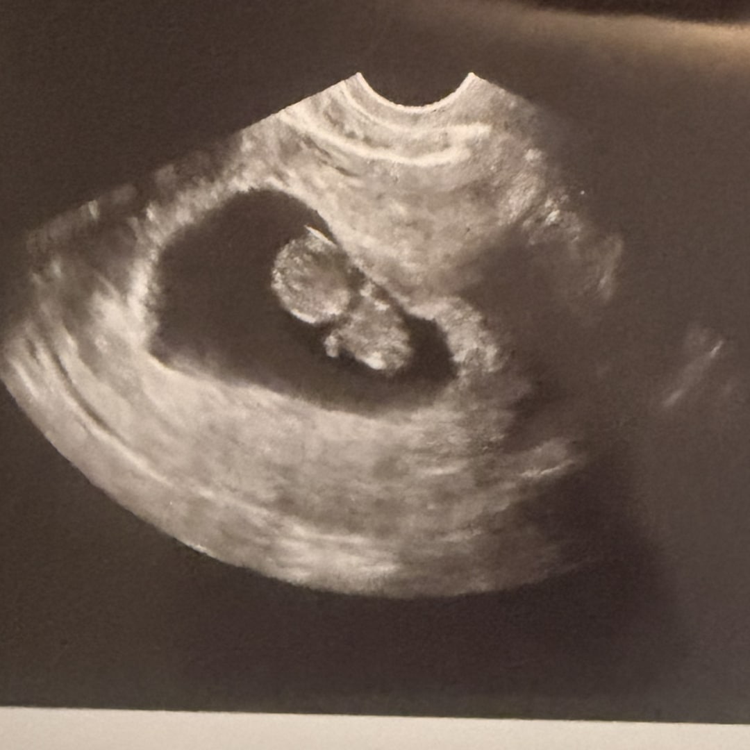 Photo shared by Marissa for their Babylist baby registry.