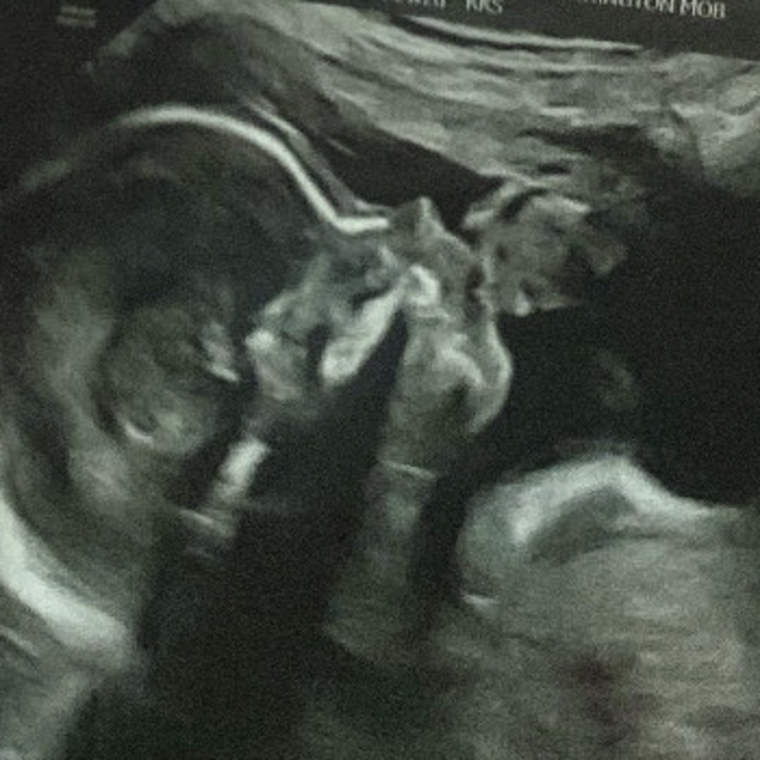 Photo shared by Ellie for their Babylist baby registry.