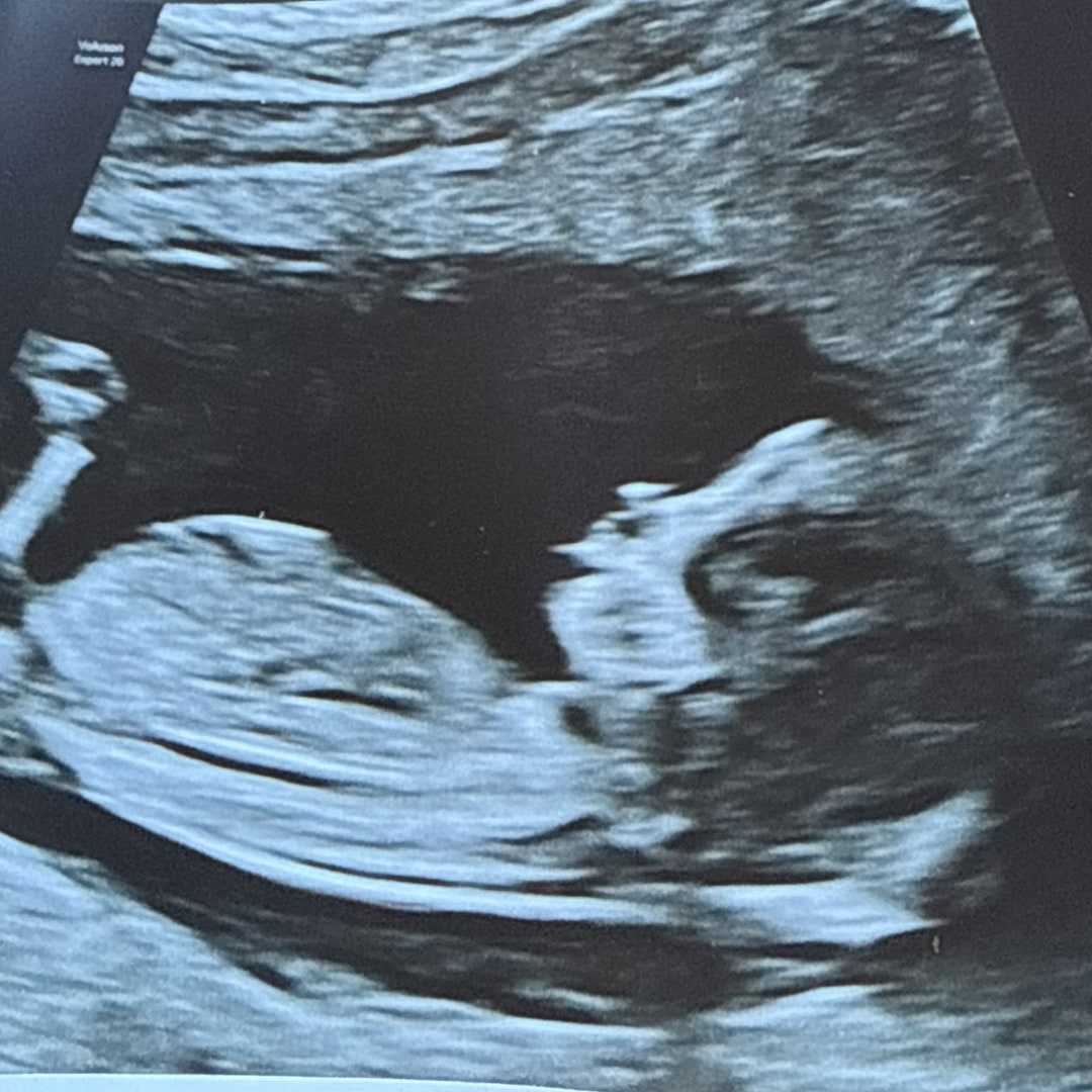 Photo shared by Sara for their Babylist baby registry.