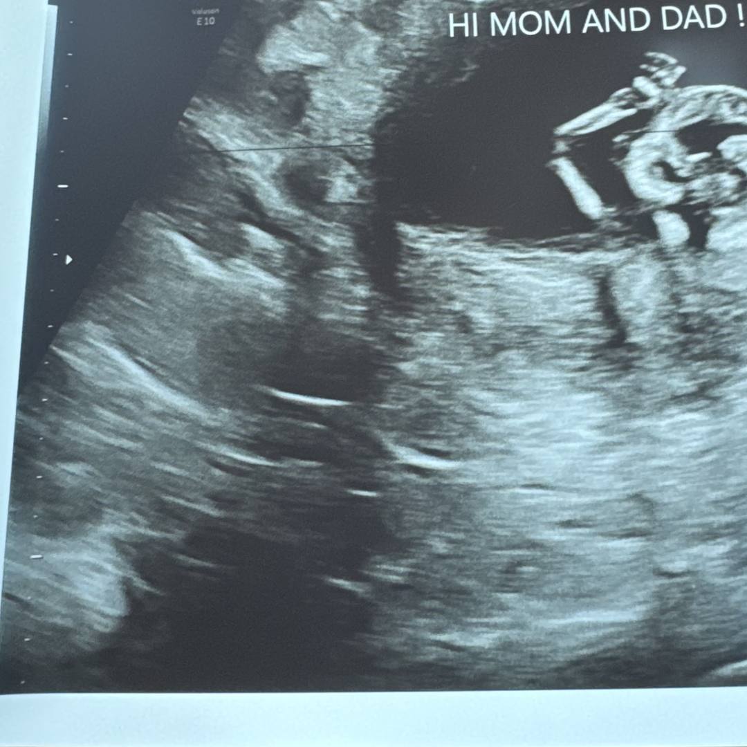 Photo shared by Kim for their Babylist baby registry.