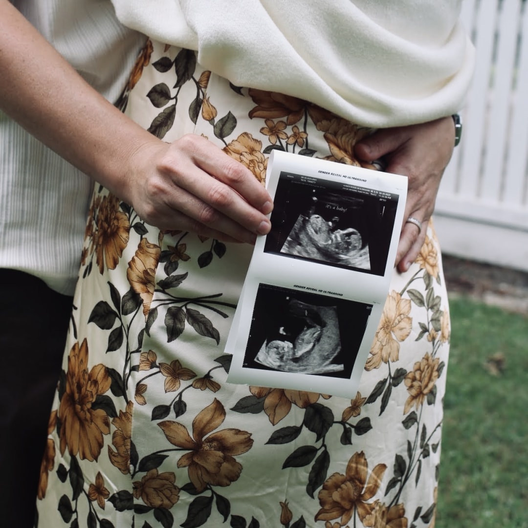 Photo shared by Trinity for their Babylist baby registry.