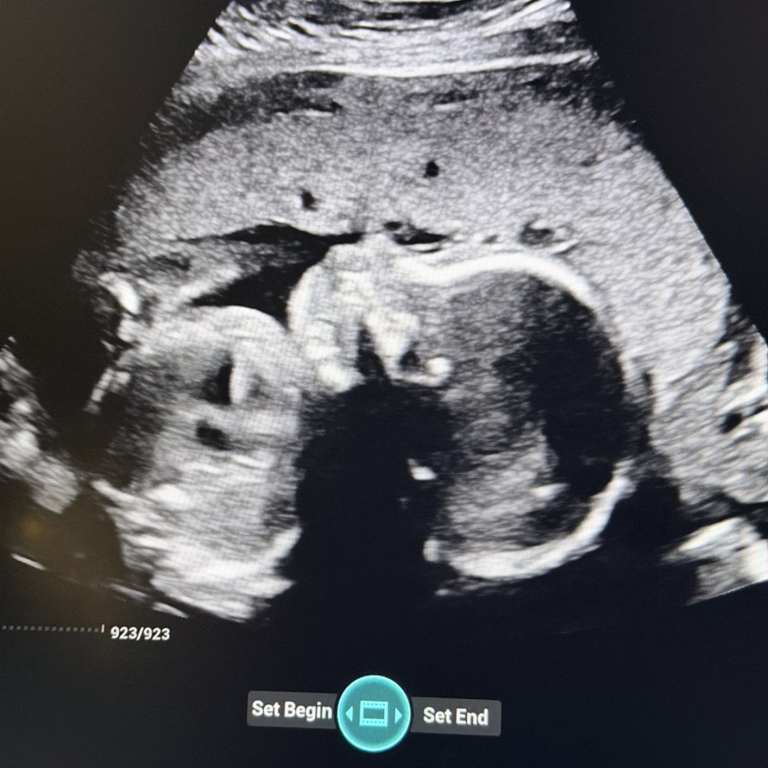 Photo shared by Maria for their Babylist baby registry.