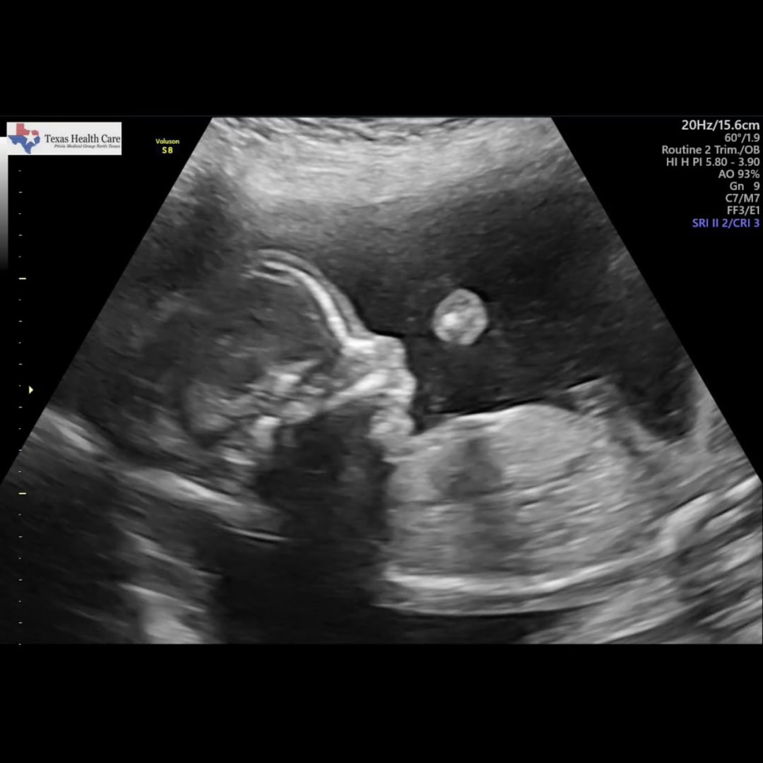 Photo shared by Deysi for their Babylist baby registry.