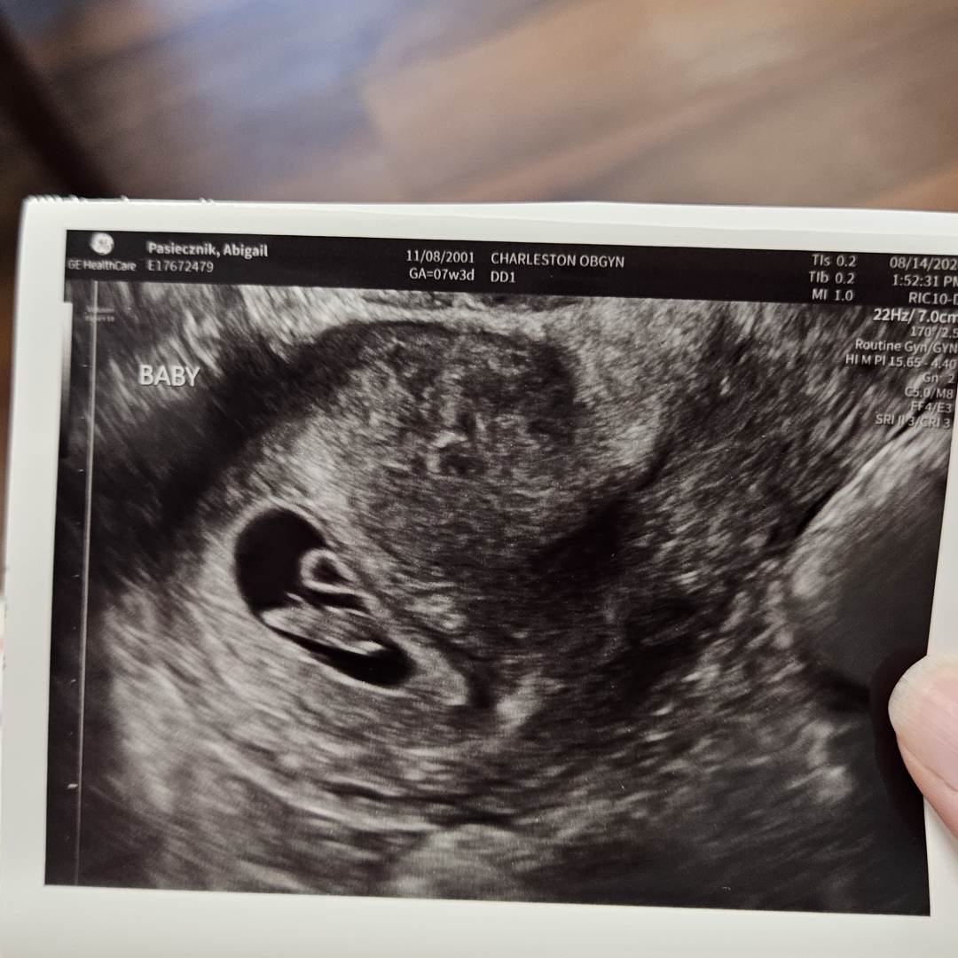 Photo shared by Abigail for their Babylist baby registry.