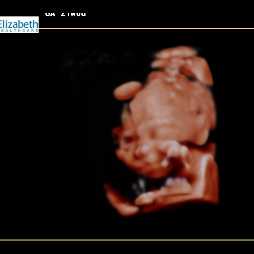 Photo shared by Shelby for their Babylist baby registry.