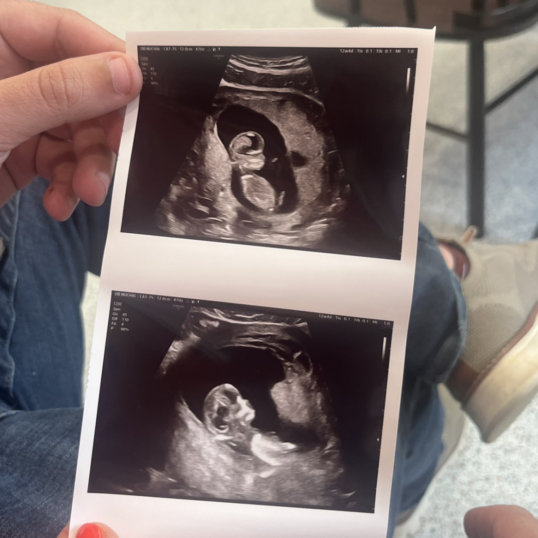 Photo shared by Katy for their Babylist baby registry.