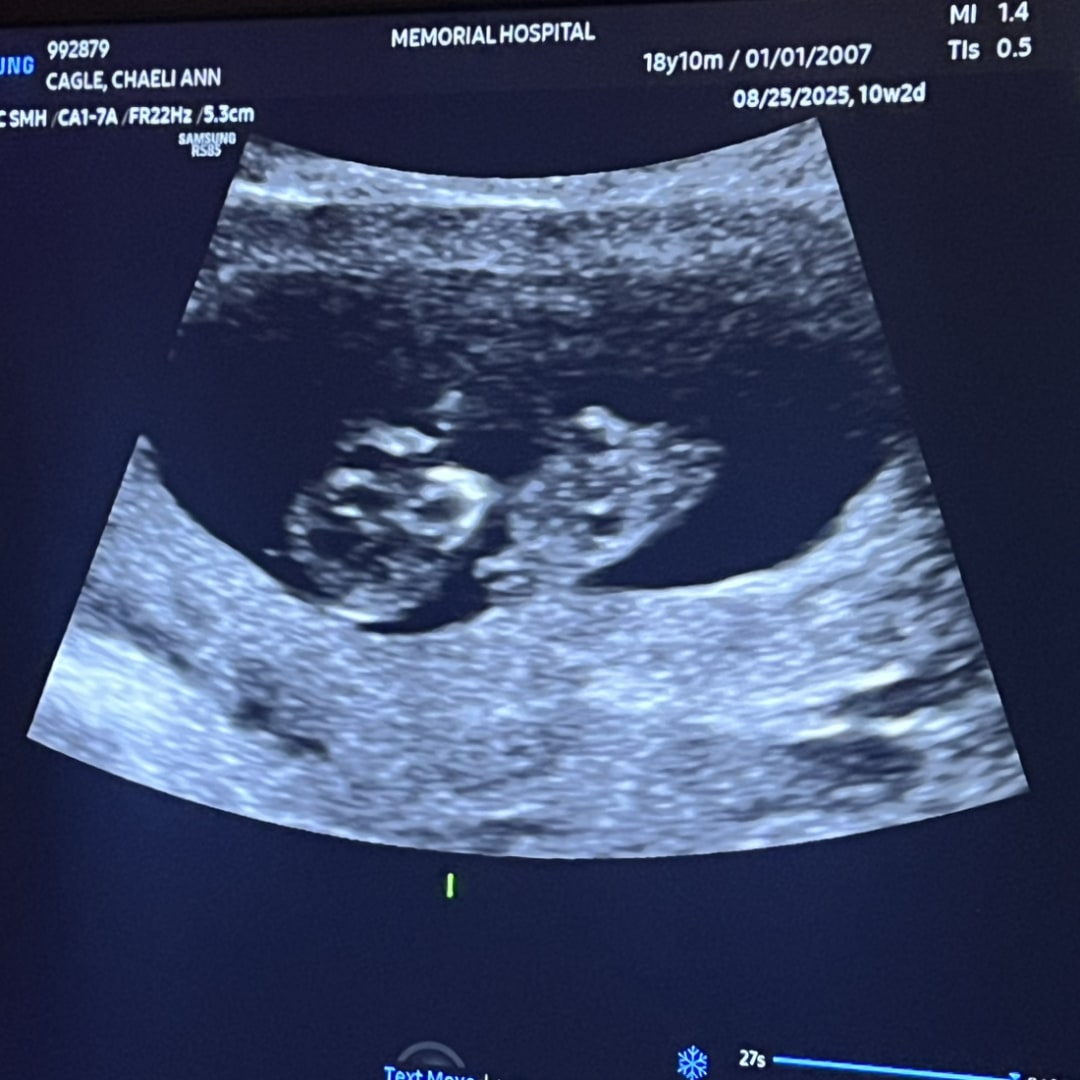 Photo shared by Chaeli for their Babylist baby registry.