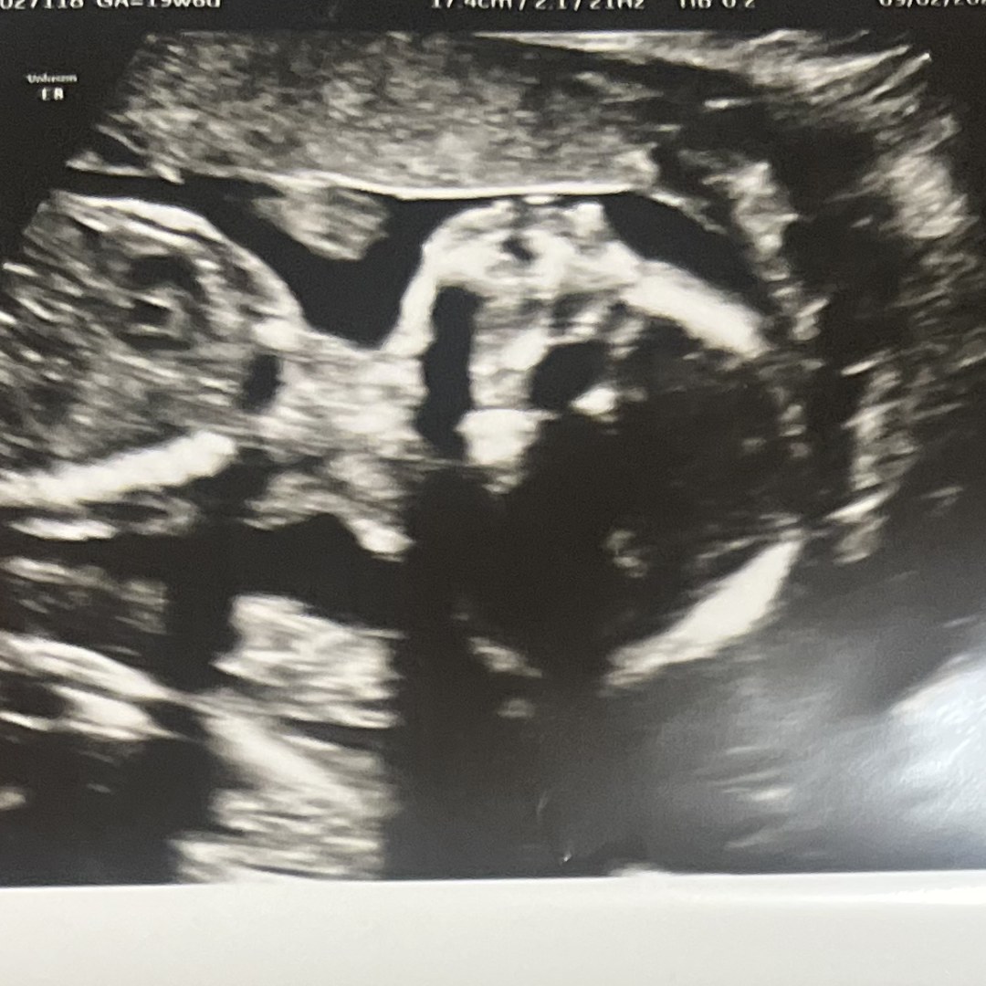 Photo shared by Cristine for their Babylist baby registry.