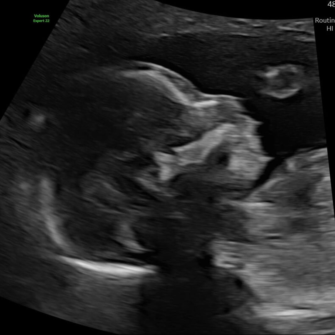 Photo shared by Meredith for their Babylist baby registry.