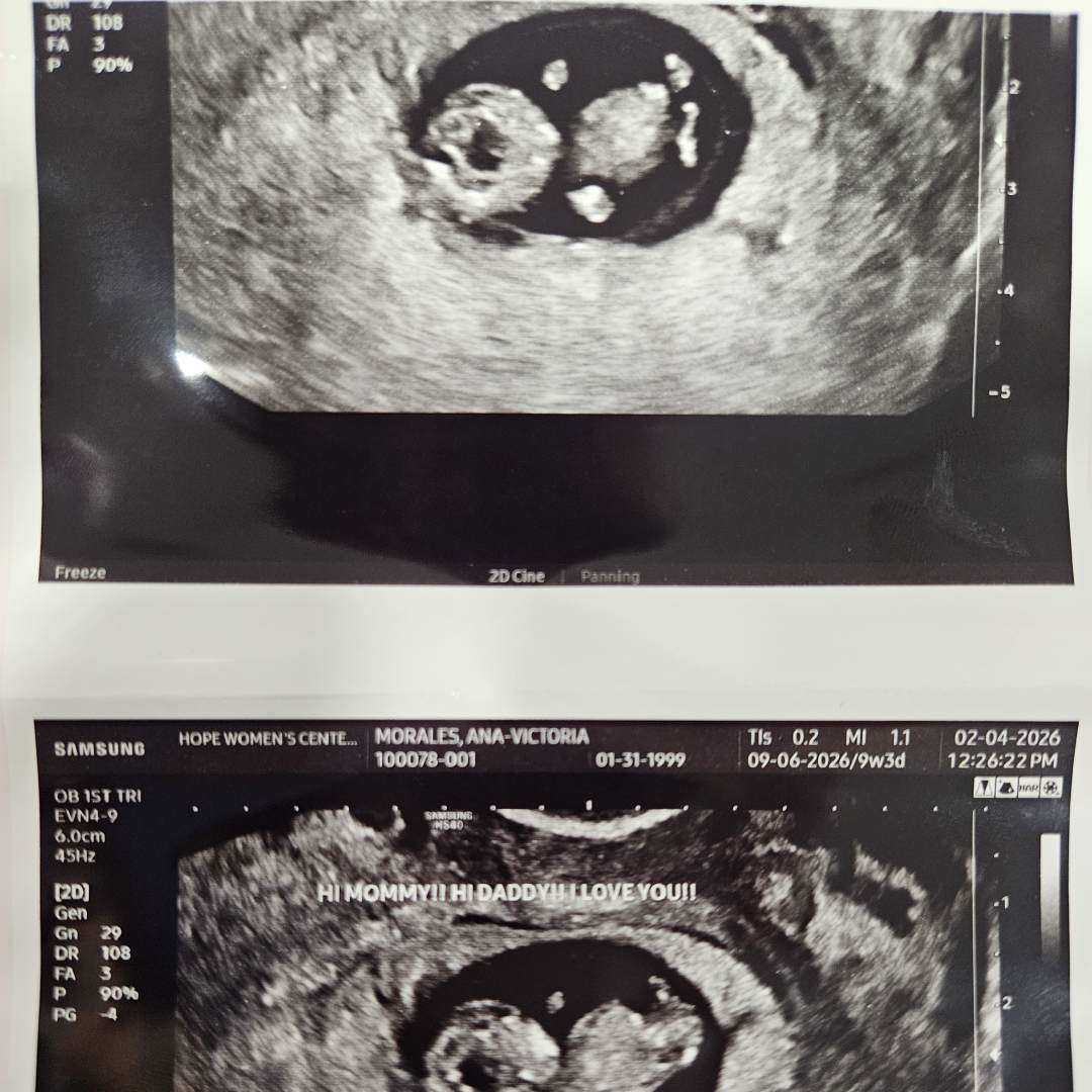 Photo shared by Ana-Victoria for their Babylist baby registry.