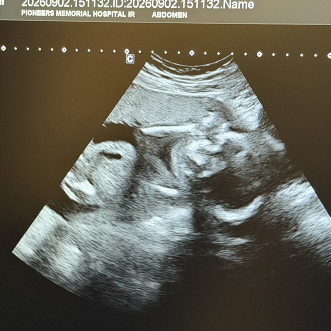 Photo shared by Grace for their Babylist baby registry.