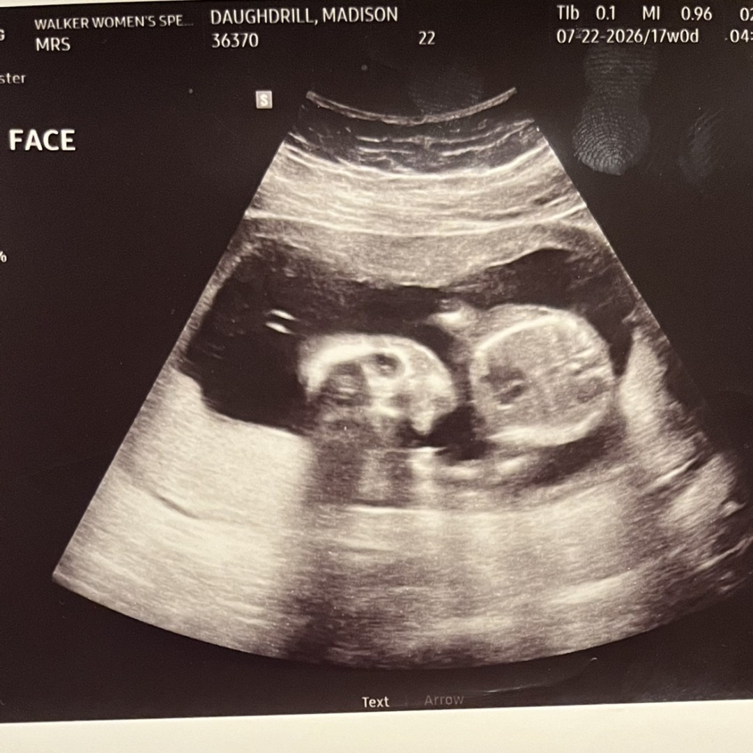 Photo shared by Madison for their Babylist baby registry.