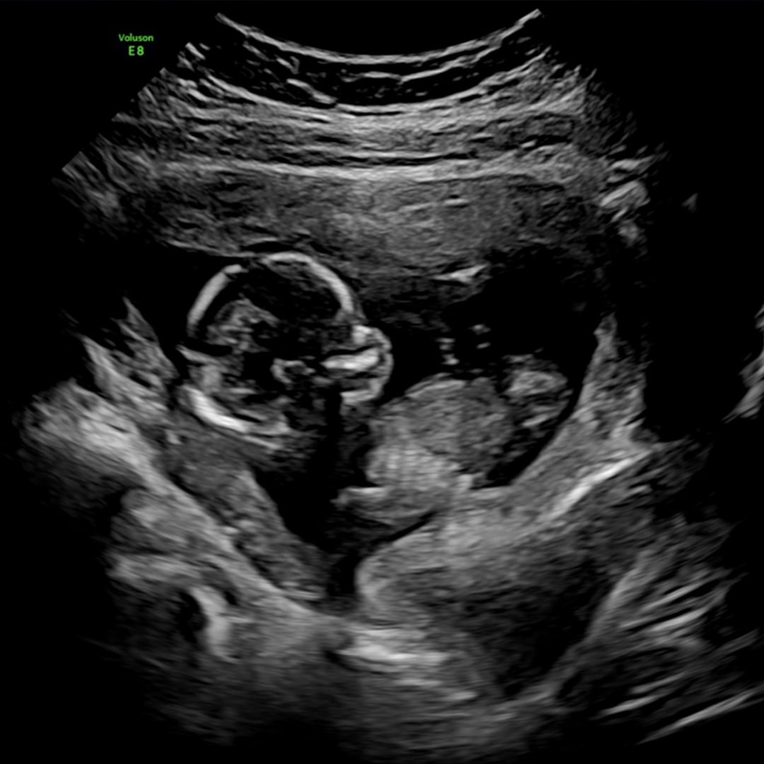 Photo shared by Giselle for their Babylist baby registry.