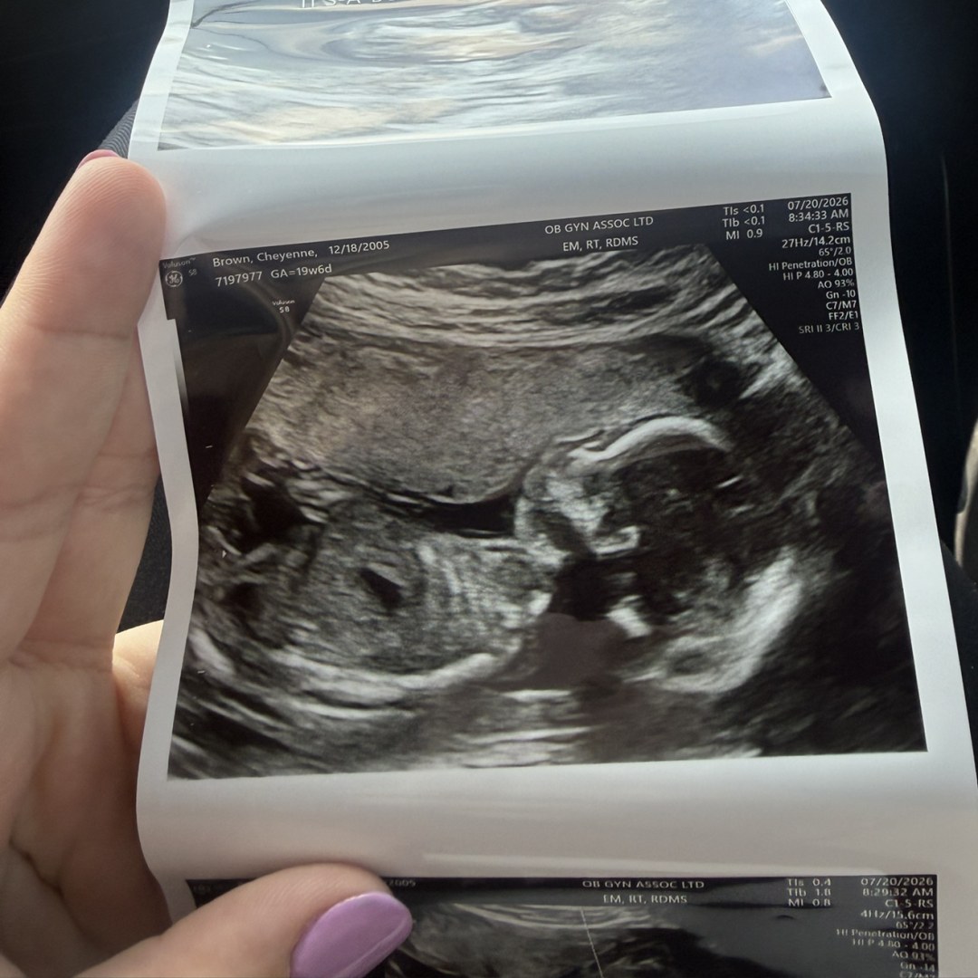 Photo shared by Cheyenne for their Babylist baby registry.