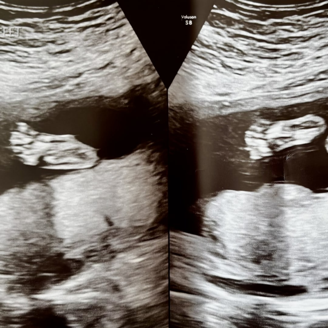 Photo shared by Riley for their Babylist baby registry.