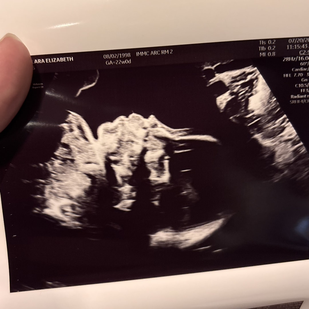 Photo shared by Clara for their Babylist baby registry.