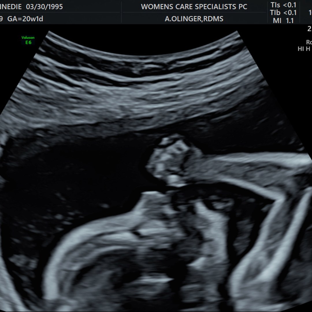 Photo shared by Kennedie for their Babylist baby registry.