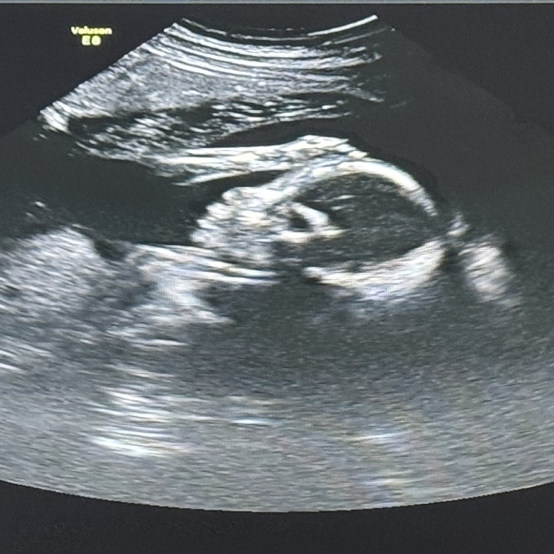 Photo shared by Serenity for their Babylist baby registry.