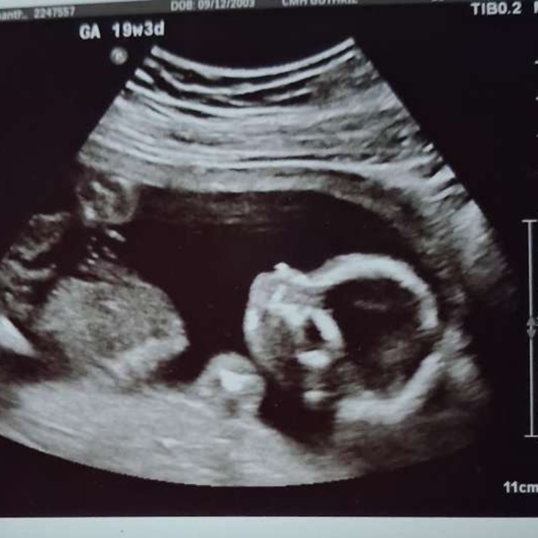 Photo shared by Sam for their Babylist baby registry.