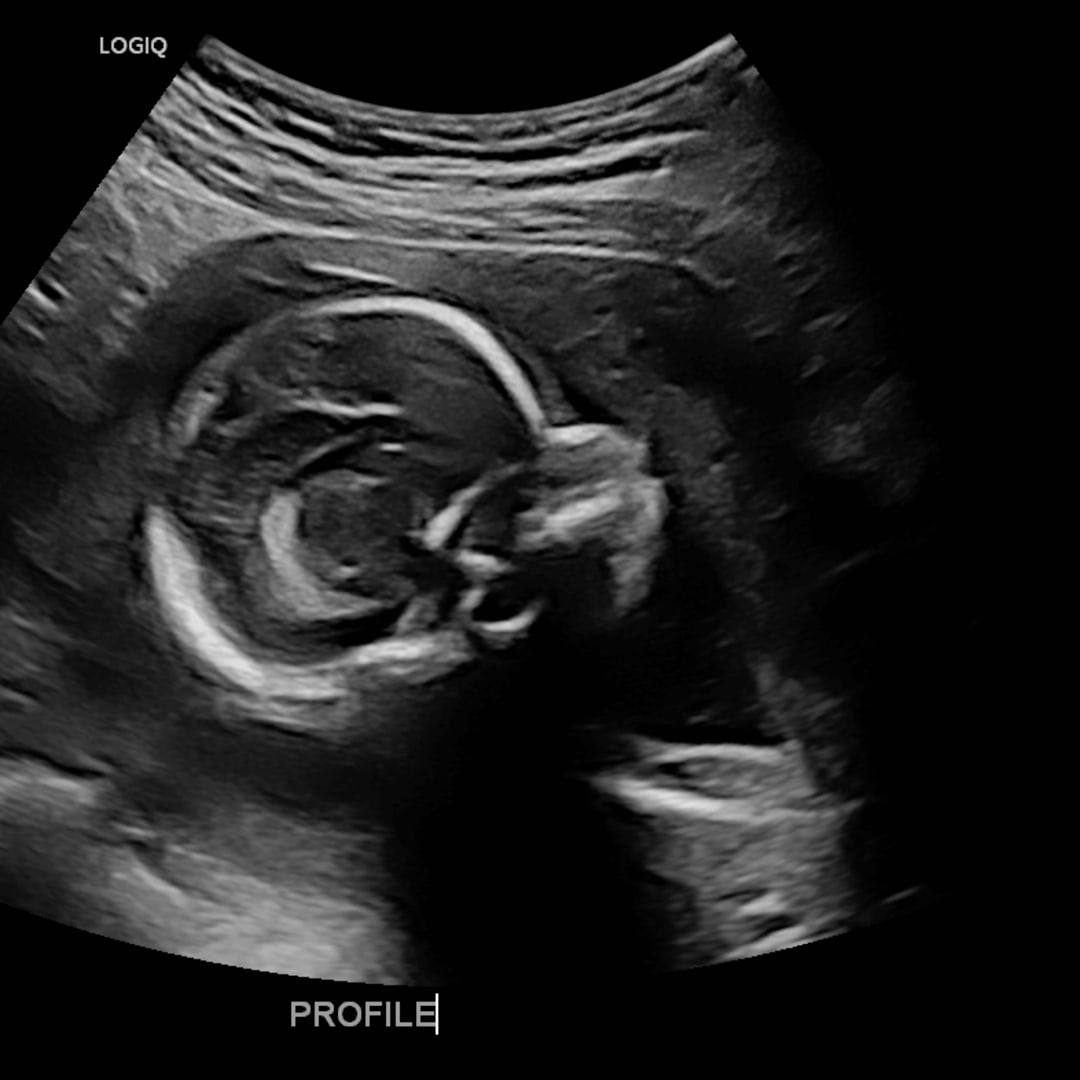 Photo shared by Avery for their Babylist baby registry.