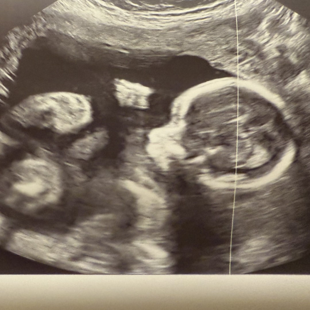 Photo shared by Adriana for their Babylist baby registry.