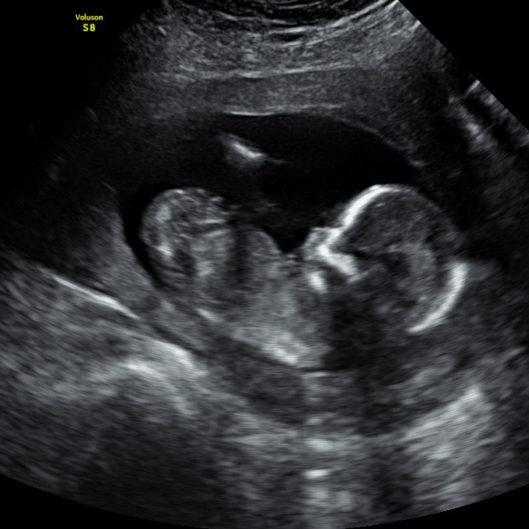 Photo shared by Ambrea for their Babylist baby registry.