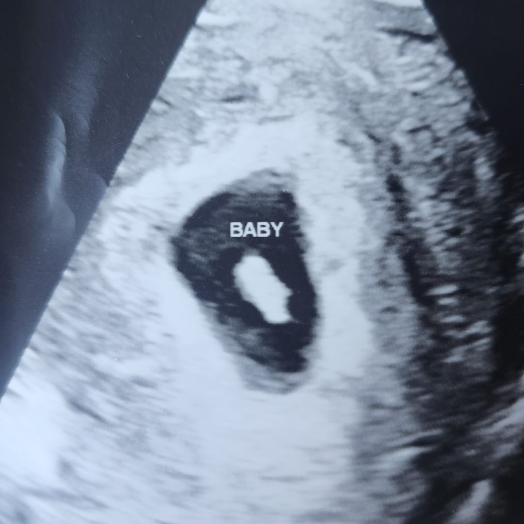 Photo shared by Amber/Chad for their Babylist baby registry.