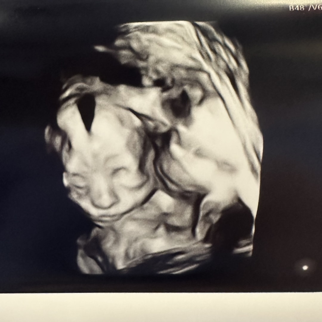 Photo shared by Emmie for their Babylist baby registry.